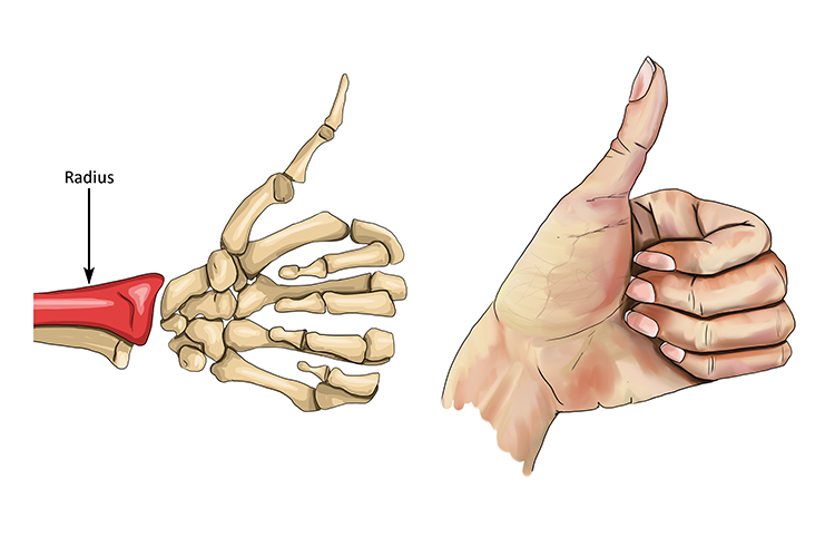 Thumbs up will position the radius on the top and ulna on the bottom